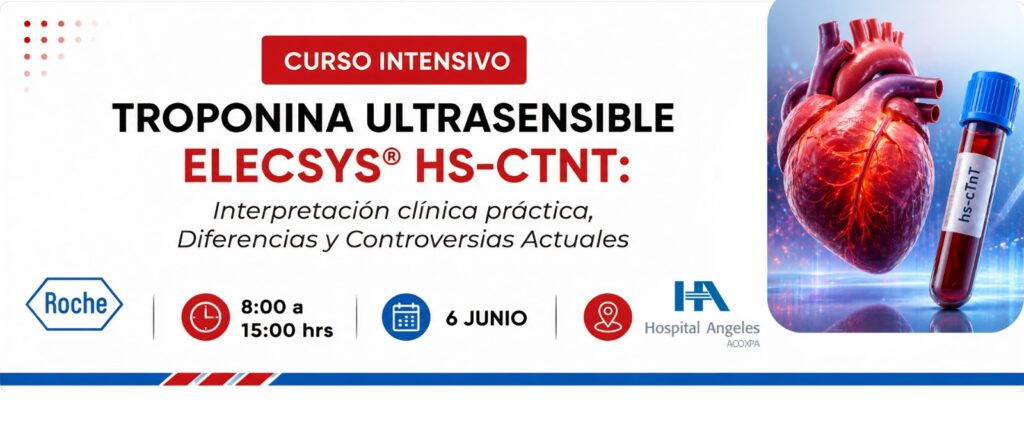 Curso Intensivo Troponina Ultrasensible