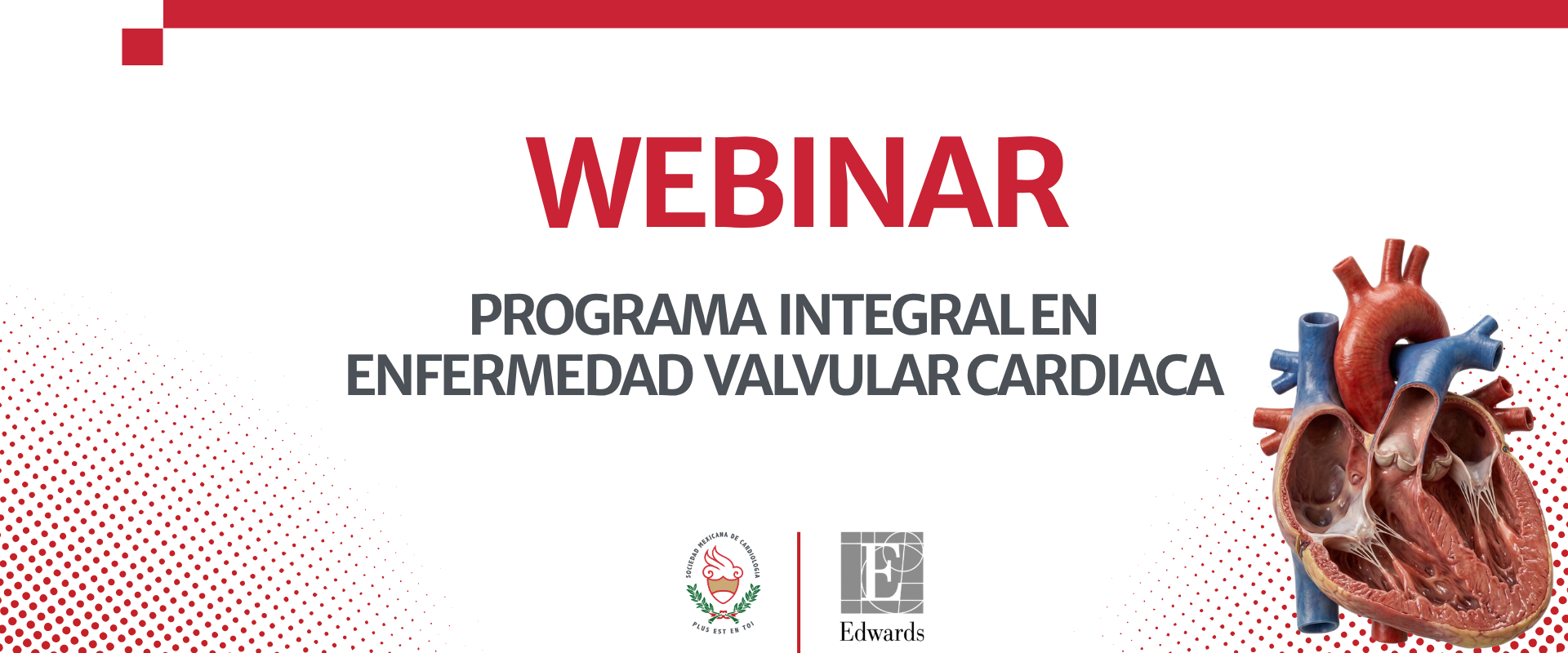 Tecnología, cirugía e intervencionismo cardiovascular | Serie Edwards